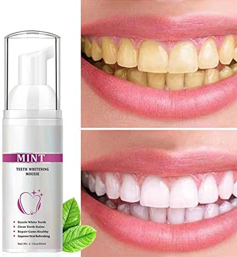 OFANYIA MUNT MOSTEN MOUSSE מסיר כתמים הלבנת שיניים לטיפול אוראלי קצף משחת שיניים שיניים ניקוי MOUSSE